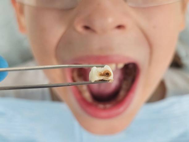 Best Weekend Emergency Dentist in Stanton, KY
